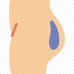 臀肌植入物图标