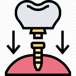 牙种植体图标