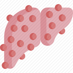 肝硬化图标