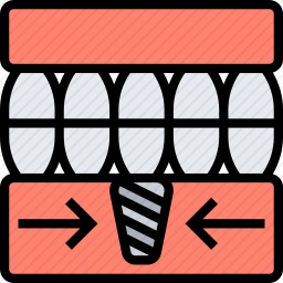 牙种植体图标
